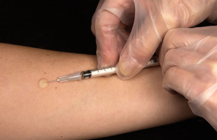 Многие не знают о диагнозе. В чем заключается главное коварство гепатита, рассказал представитель ВОЗ