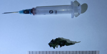 18‑летняя девушка умерла от передозировки в Бресте: в организме нашли восемь видов наркотиков