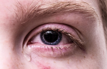 Женщина стала видеть драконов вместо людей из-за редкой болезни